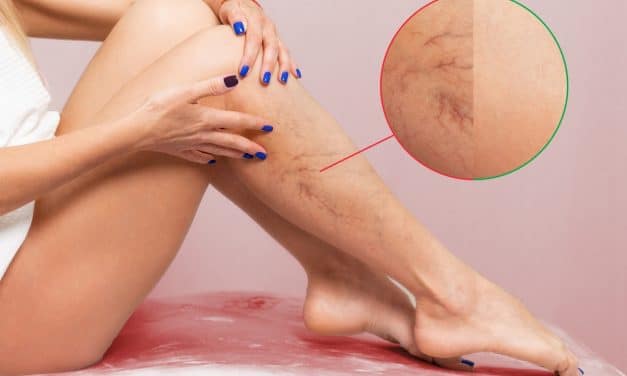 The Foundation of Circulation: Strengthening Your Vascular Health Naturally